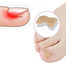 Adesivo NailFREE™ - Elimina Fungos e Bactérias e Desencrava as Unhas (Ultimas Unidades)