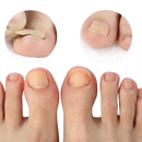 Adesivo NailFREE™ - Elimina Fungos e Bactérias e Desencrava as Unhas (Ultimas Unidades)